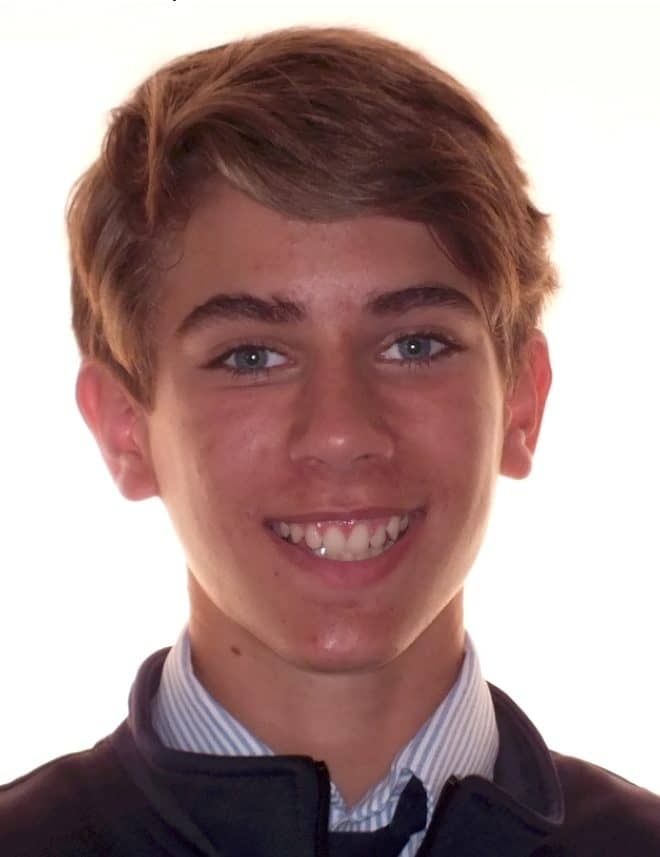 Teen's Before and After Orthodontics Photos in Carrollton Texas