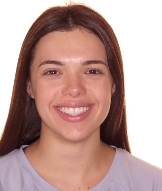 Teen's Before and After Orthodontics Photos in Carrollton Texas