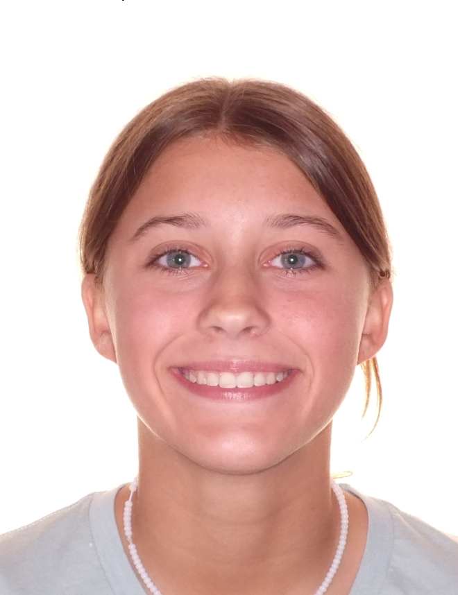 Before and After Gap Teeth Photos by Patenaude Orthodontics in Carrollton Texas