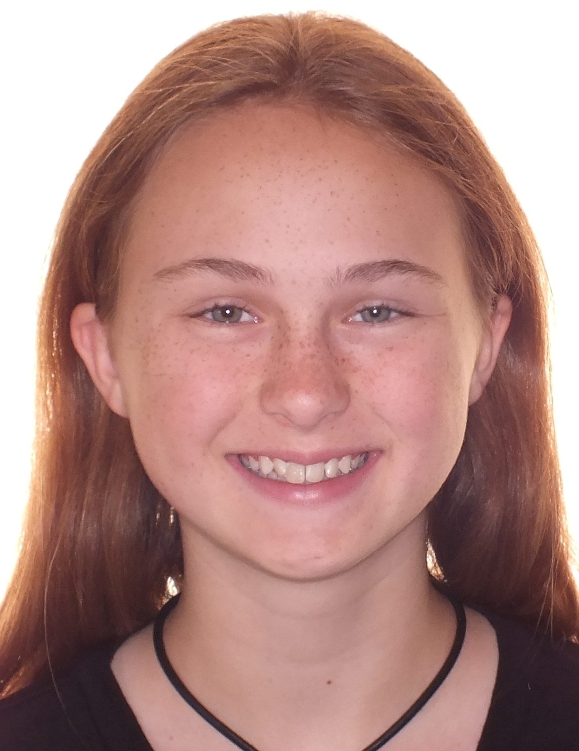 Teen's Before and After Orthodontics Photos in Carrollton Texas