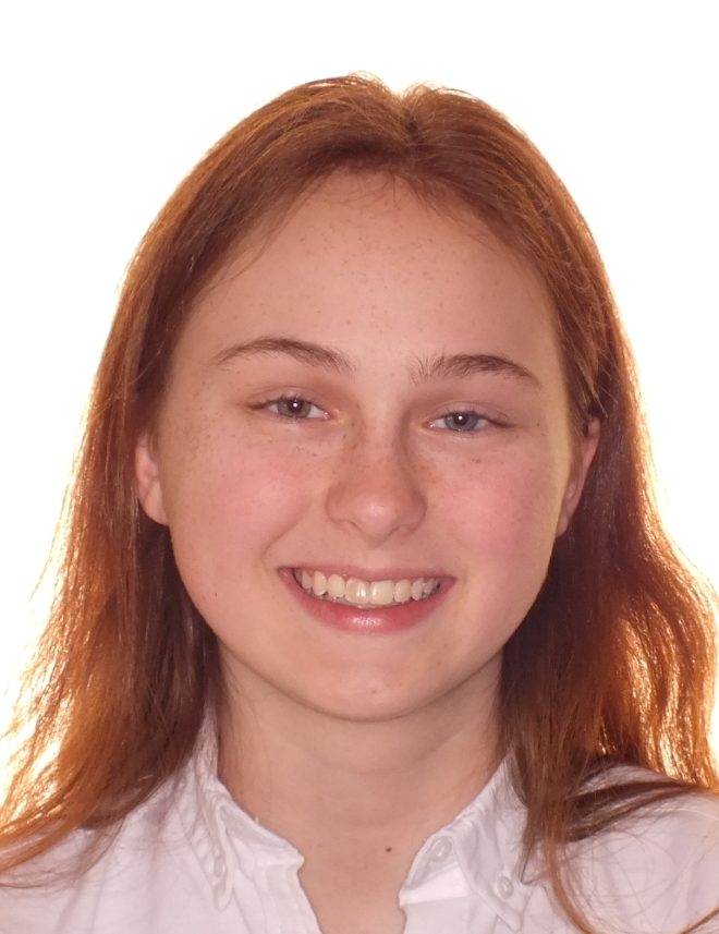 Teen's Before and After Orthodontics Photos in Carrollton Texas