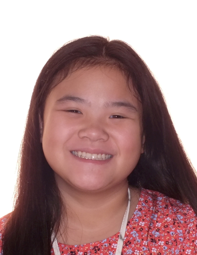 Jaw Smile Expansion Before and After Photos by Patenaude Orthodontics in Carrollton Texas