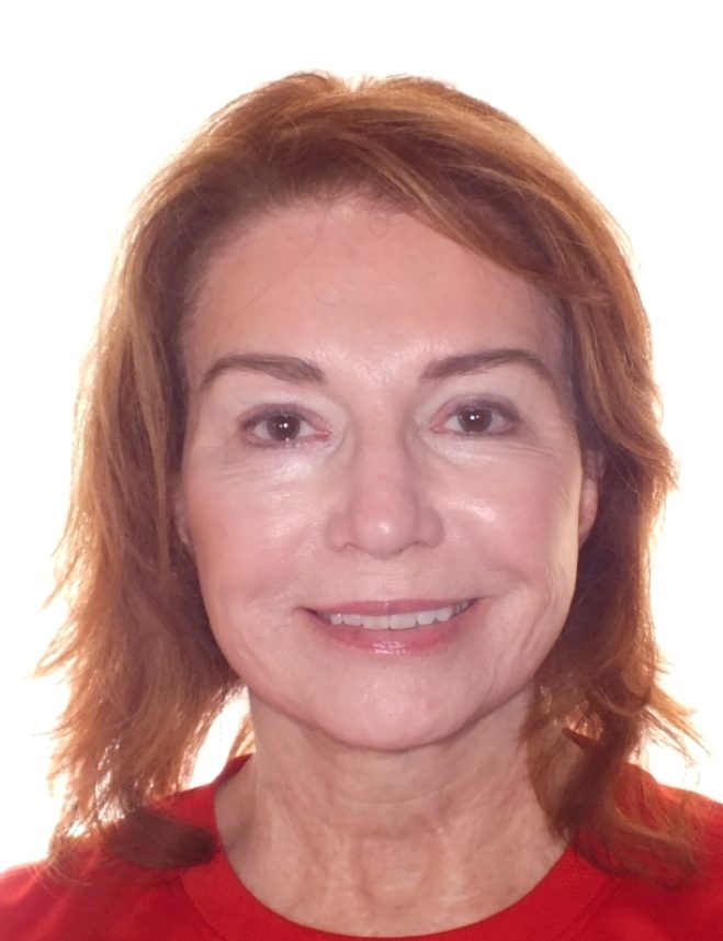 Adult's Before and After Orthodontics Photos in Carrollton Texas