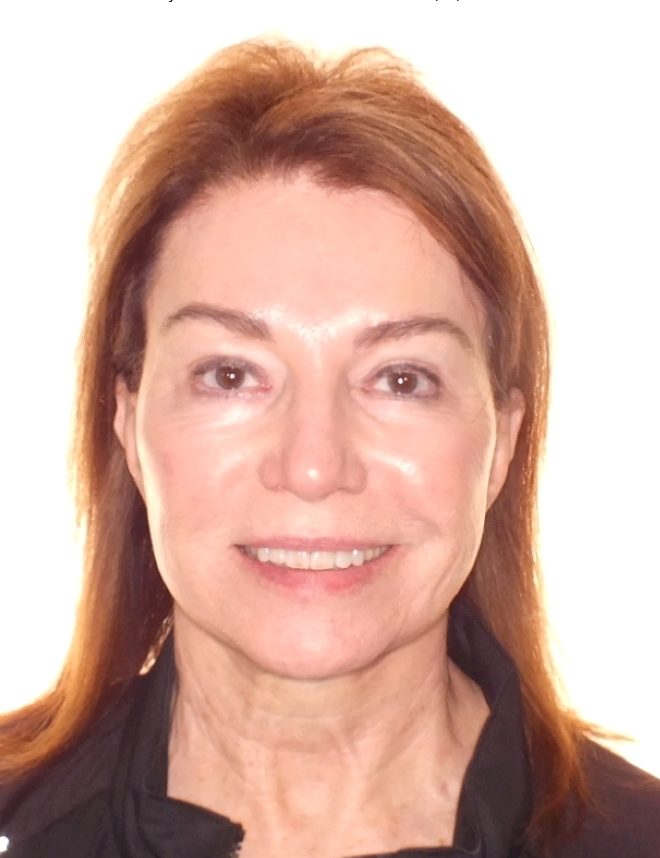 Adult's Before and After Orthodontics Photos in Carrollton Texas