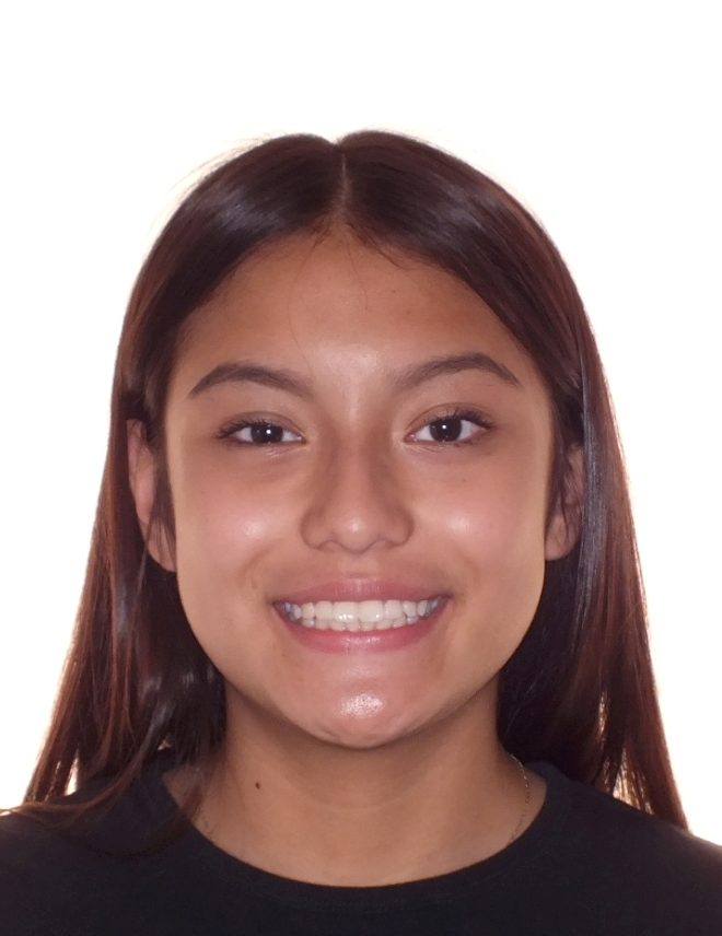 Teen's Before and After Orthodontics Photos in Carrollton Texas