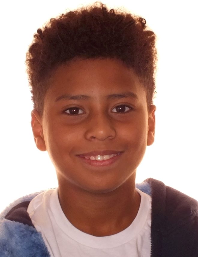 Before and After Teeth Photos by Patenaude Orthodontics in Carrollton Texas