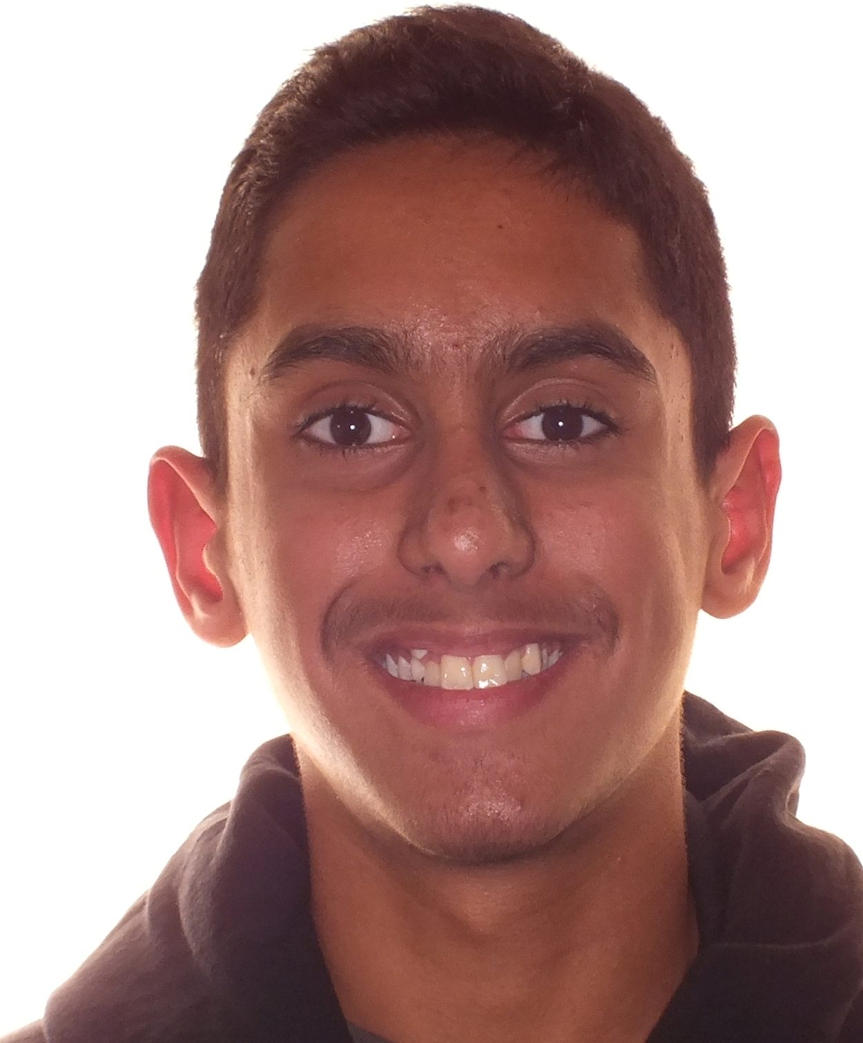 Before and after teenager teeth photos by Dr. Patenaude Orthodontics in Carrollton TX. Serving all of Dallas County, Denton County, and Collin County.